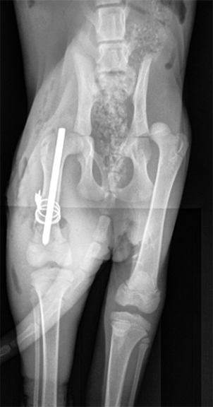 email-hmh-puffin-xray-right-femur-after x-ray of a woman's hip